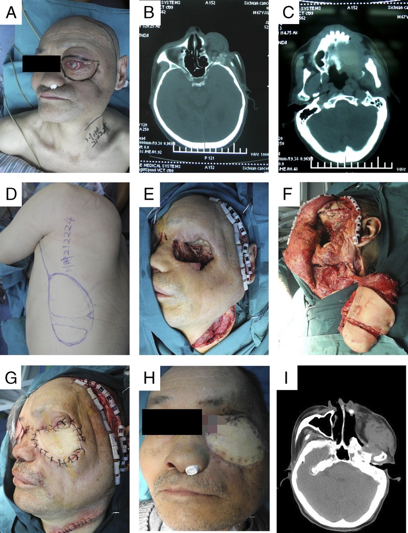 FIGURE 1