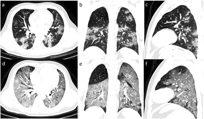 Fig 2