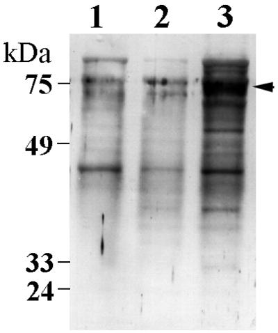 FIG. 5