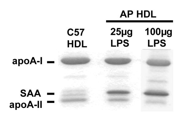 Figure 1A