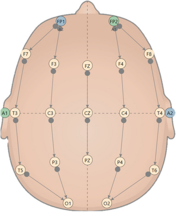Fig. 2