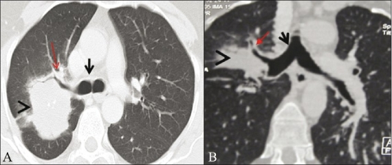 Figure 5 (A, B)