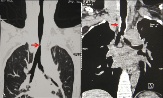 Figure 4 (A, B)