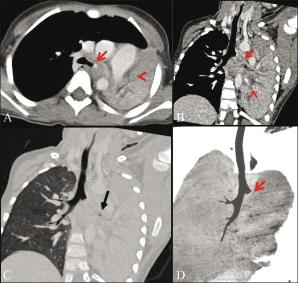 Figure 2 (A-D)