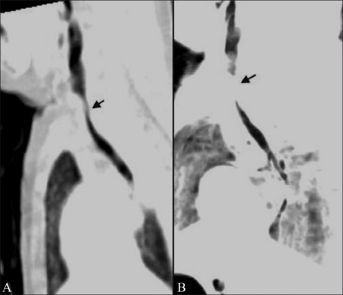 Figure 1 (A, B)