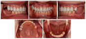 Figure 15