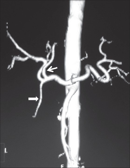 Figure 17