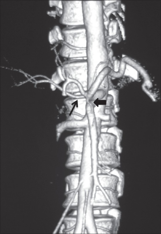 Figure 15