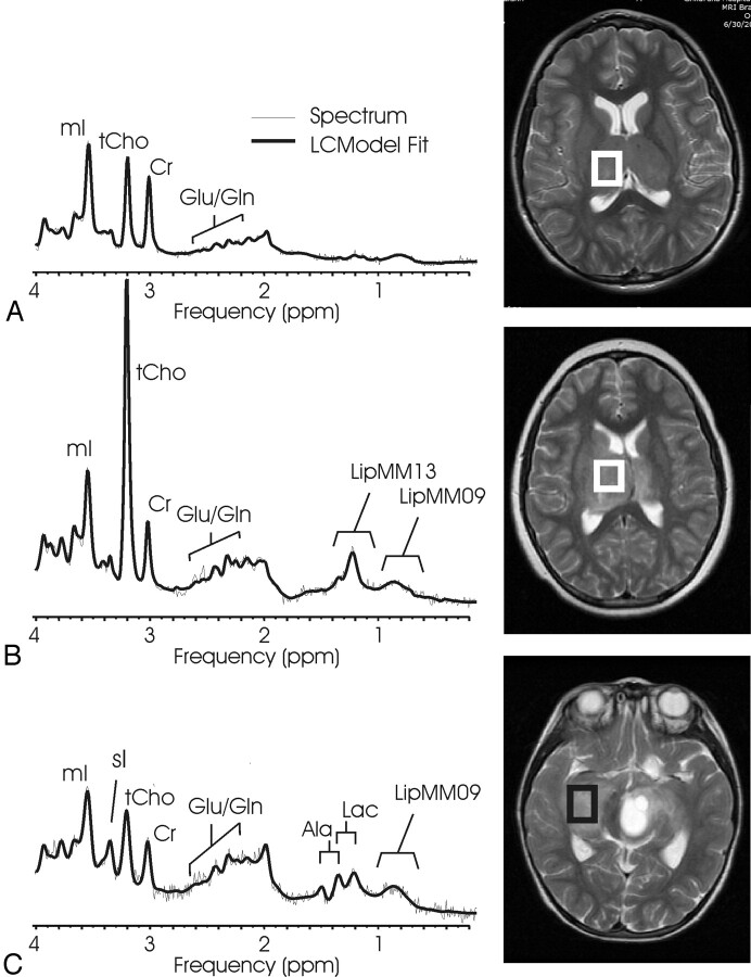 Fig 4.