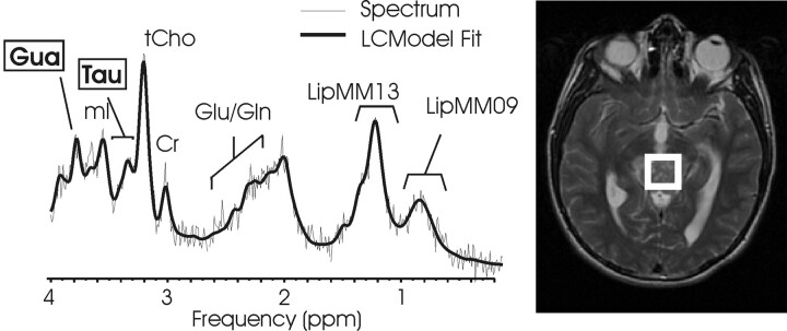 Fig 6.