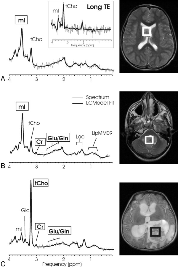 Fig 3.