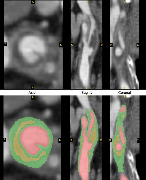 Figure 2