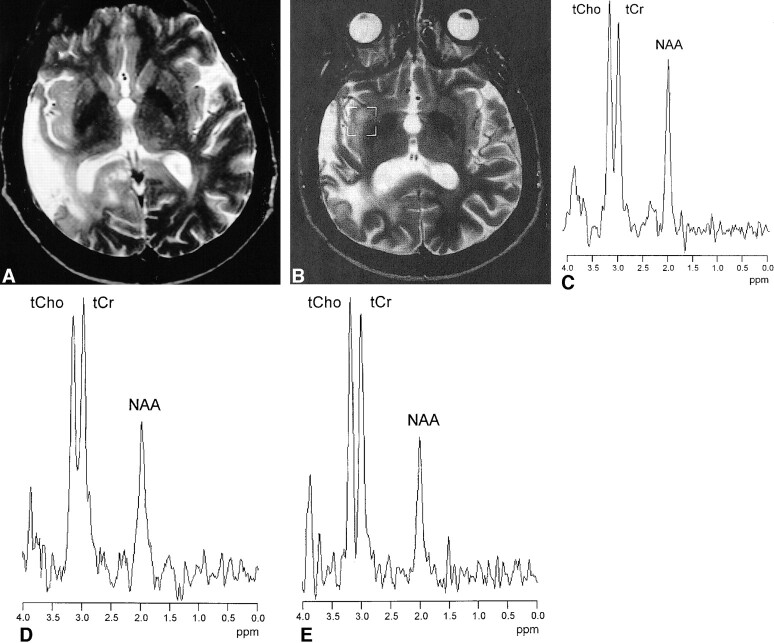 fig 3.