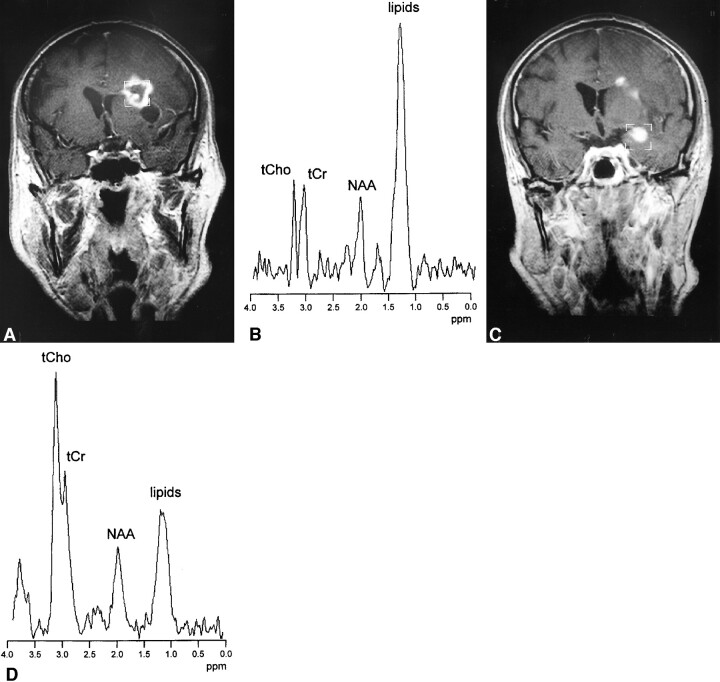 fig 1.