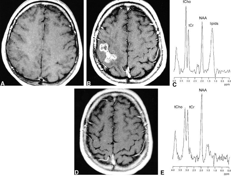 fig 2.