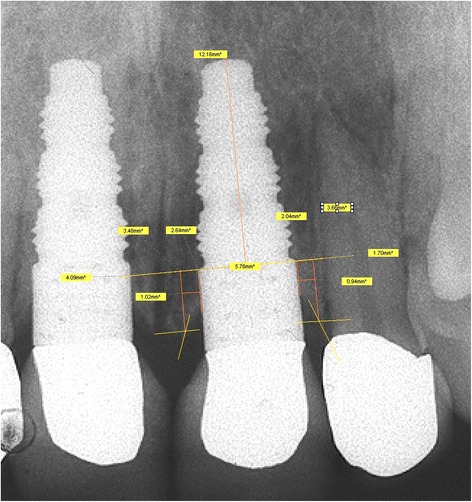 Fig. 5