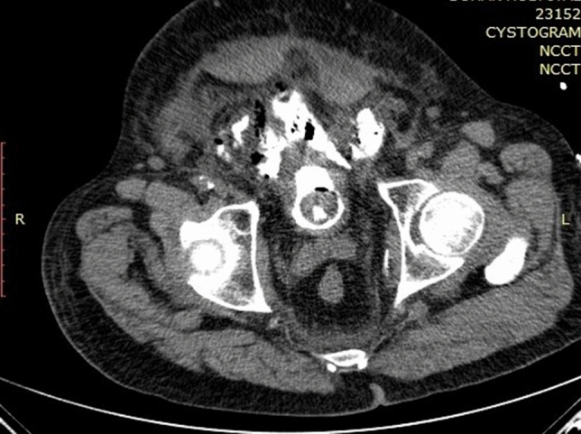 Fig. 1