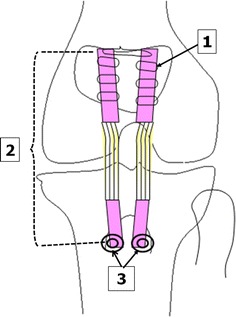 Fig. 1