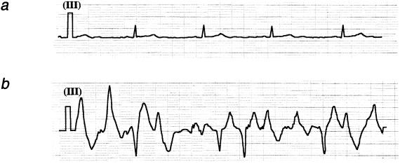 Figure  1