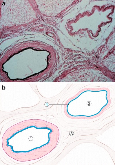 Fig. 1