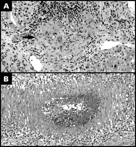 Figure 2  