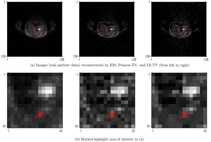 Fig 10