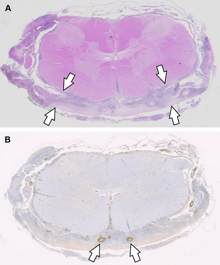 Fig. 12