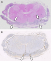 Fig. 12