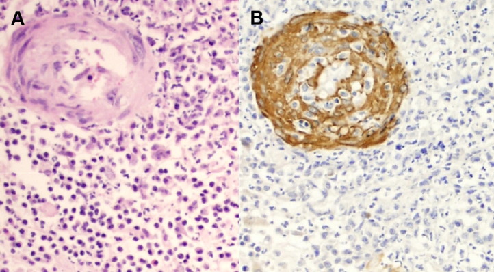 Fig. 11