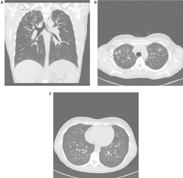 Fig. 1