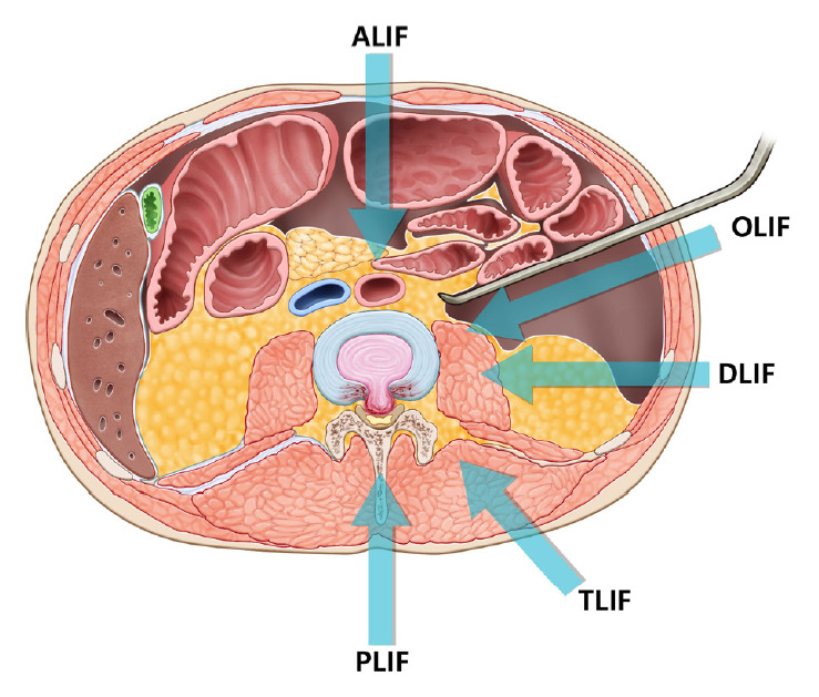 Fig. 1.