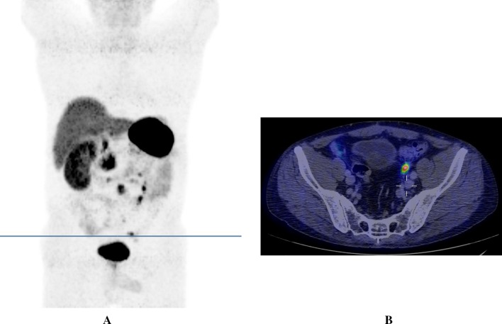 Fig. 1