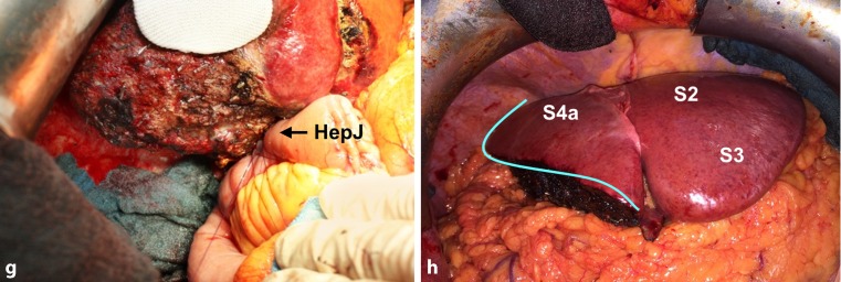 Fig. 1 (continued)