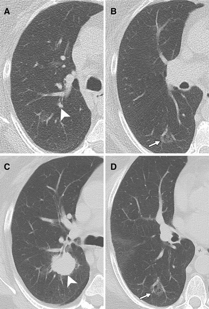 Figure 3: