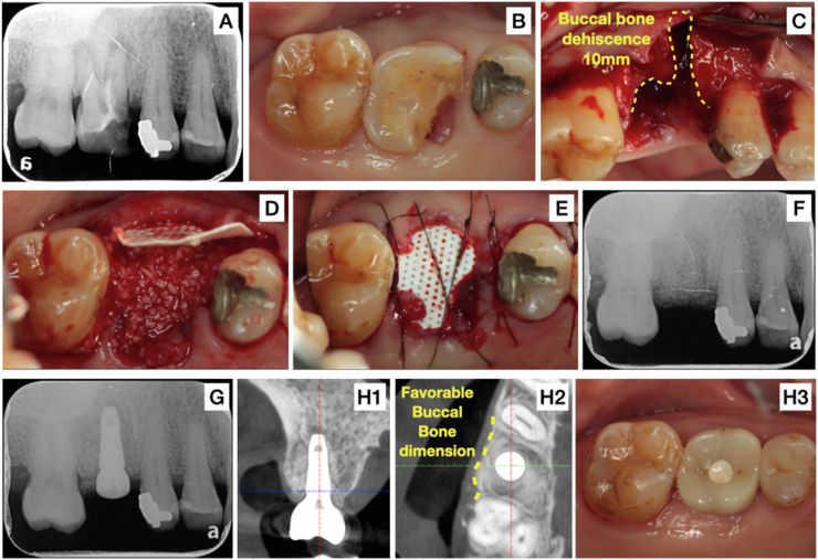 Figure 1