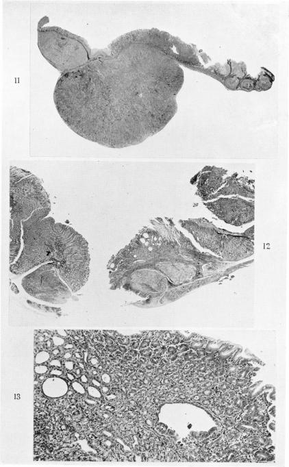 Figs. 11-13