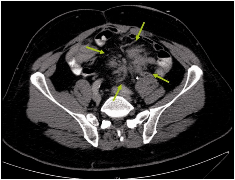 Figure 5.