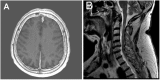 Fig. (1)