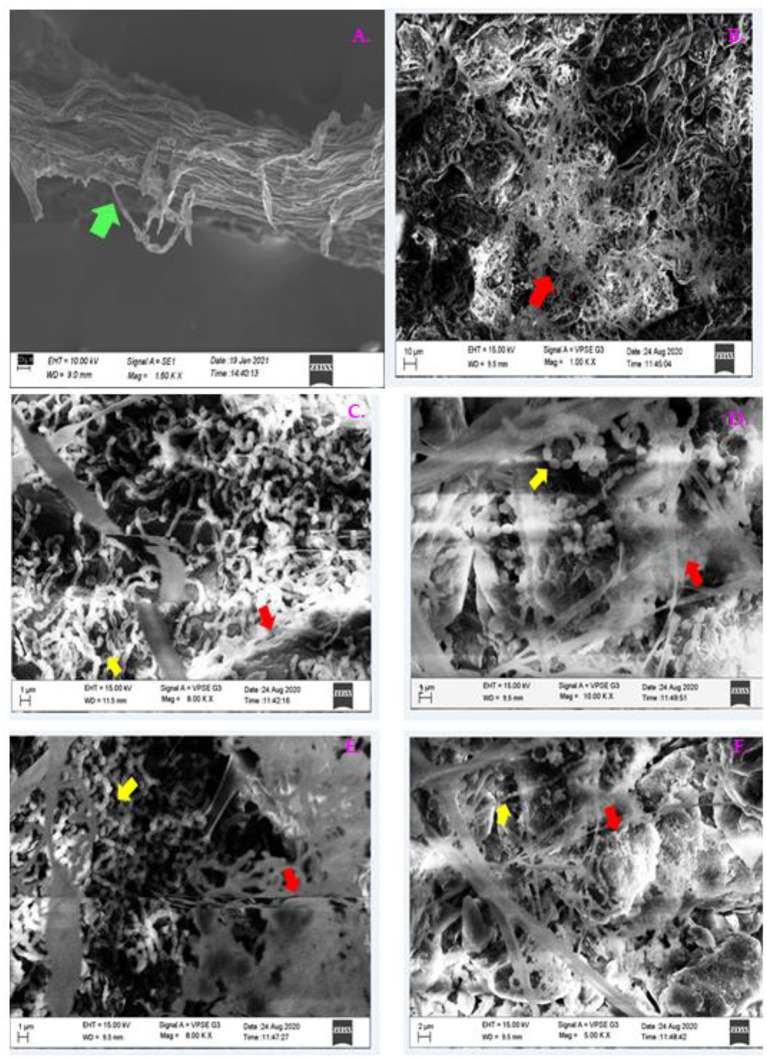 Figure 14