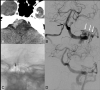 Fig 4.