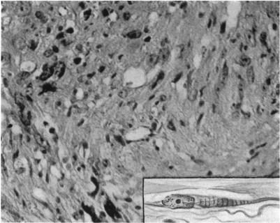 Fig. 5 (Case II).