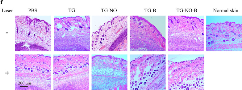 Fig. 10