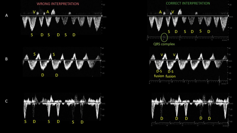 Figure 3