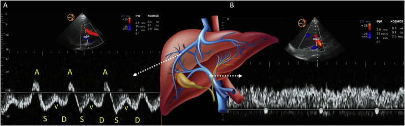 Figure 2