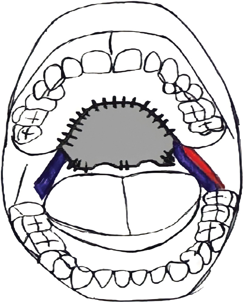 Fig. 6.