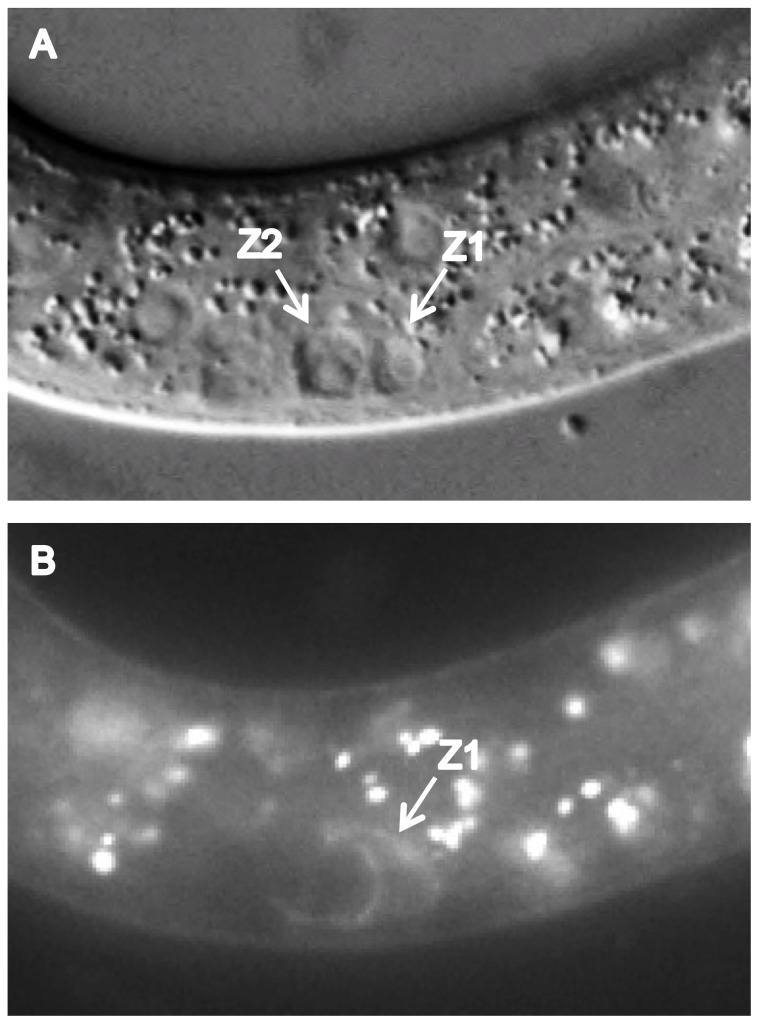 Figure 11