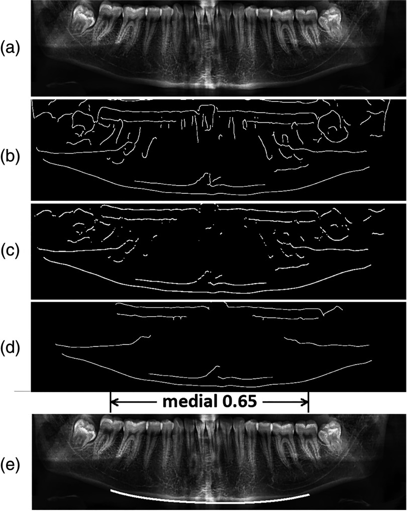 Fig. 5