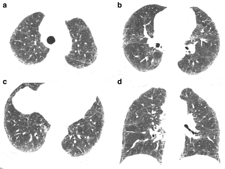 Figure 11.