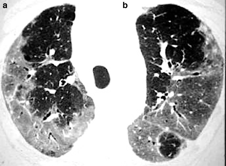 Figure 13.