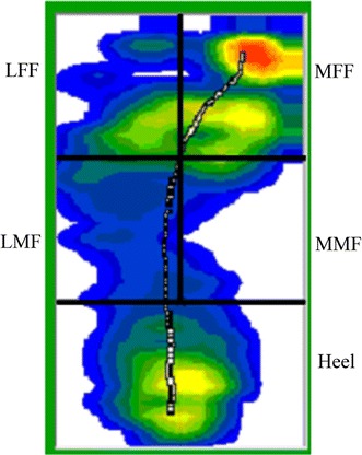 Fig. 1